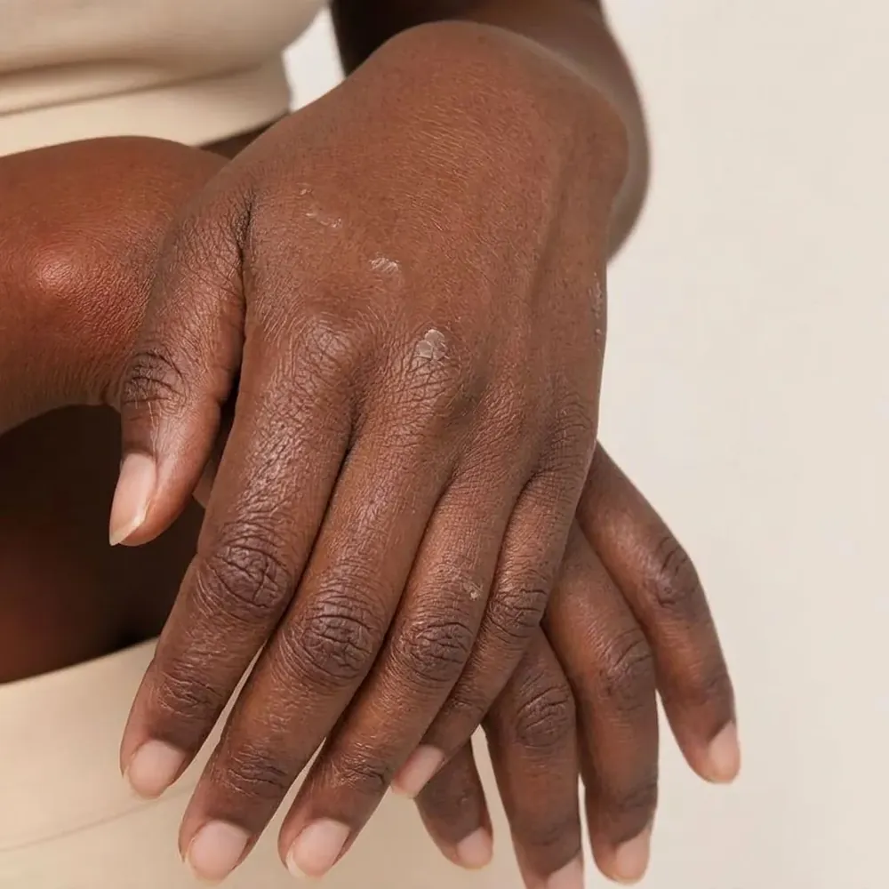 Hands & knuckles, dry skin illustration